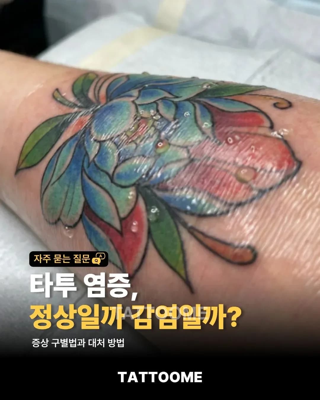 타투 염증, 정상일까 감염일까? | 증상 구별법과 대처 방법