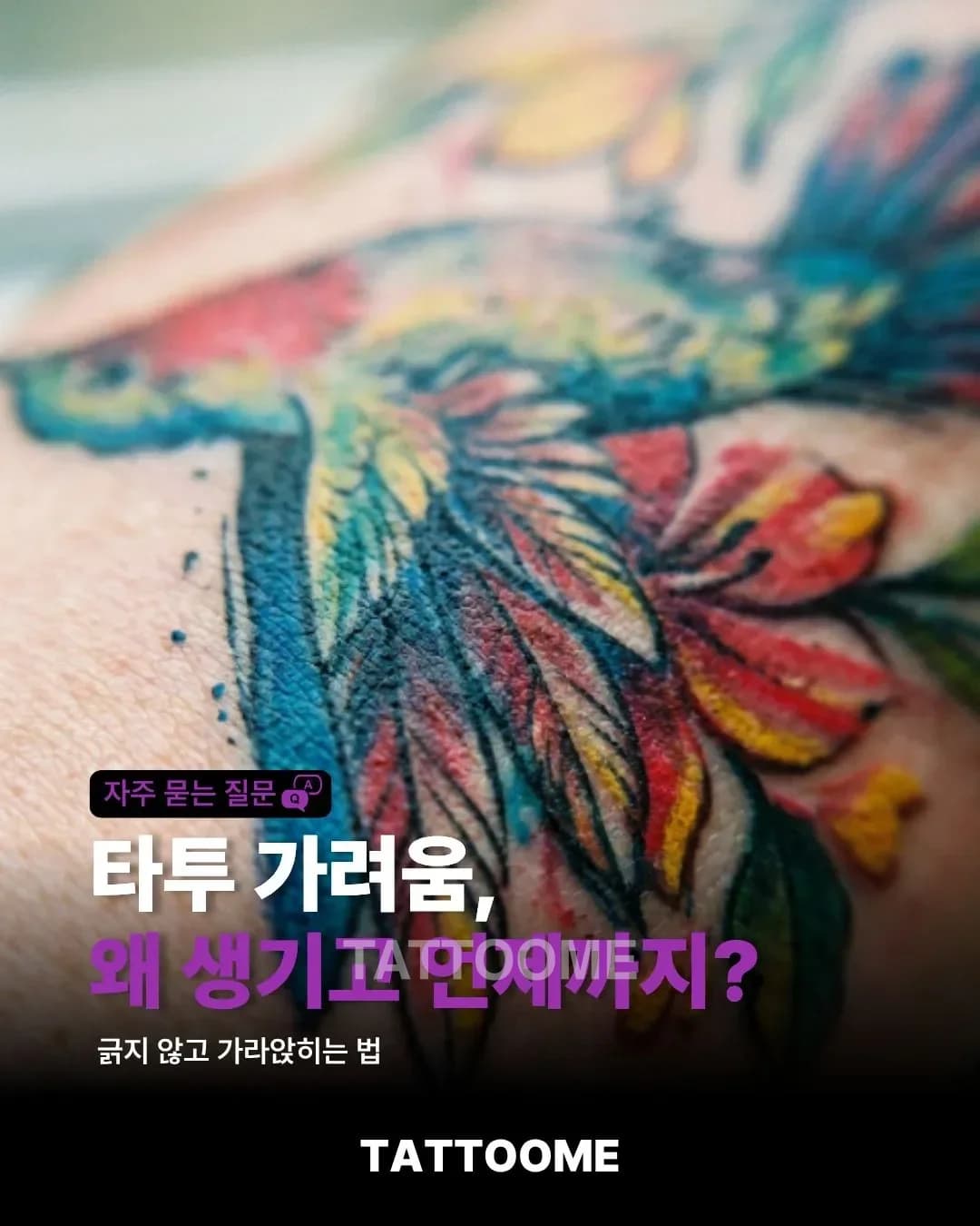 타투 가려움, 왜 생기고 언제까지? | 긁지 않고 가라앉히는 법